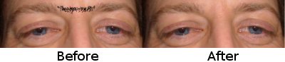 Eyebrows Waxed - Before and After